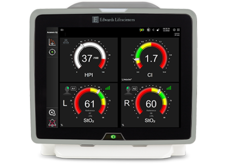 バクスターFマウント 5.3.5